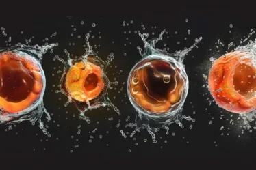 Apoptosis showing a cell shrinking and breaking into apoptotic bodies for immune system removal
